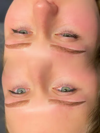 Karla Des Salon Beauty | Icoone laser med 2